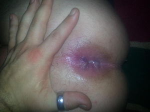 Cummy hole