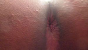 MarcBuns9A