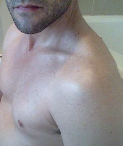 chest june 2104