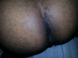 Angle view he chose to do.  ;)