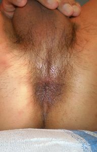 P2070022