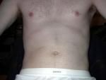 mychest