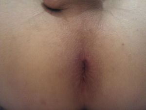 WP 000025
