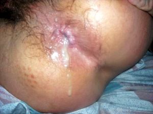 my POZ cum in NEG hole