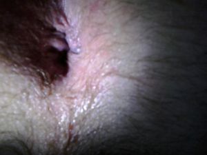 UsedHole1 June1