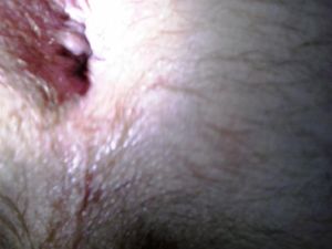 UsedHole2 June1