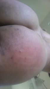 Red spanked butt
