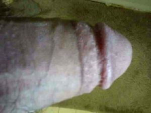 needs a mouth