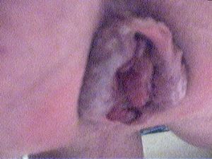 Rosebud after pumping my hole