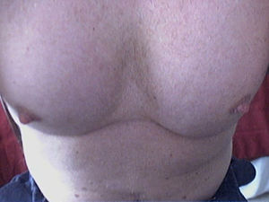 Tits - keep the nips happy and you can do whatever you want.