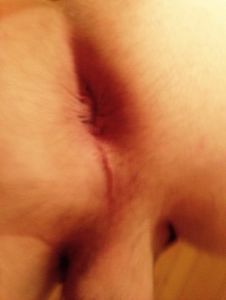 My Asshole