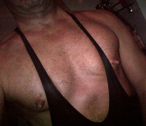 ChestX2