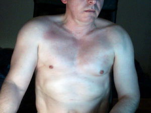 body