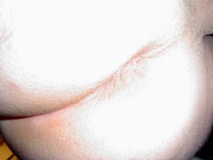Hole