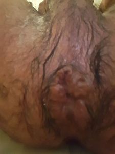 hungry hole