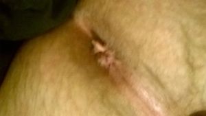 My Ass