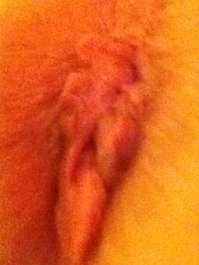 my hole