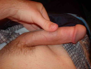 Dick Shot
