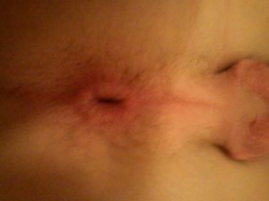my hole