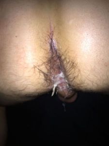 My Hole