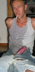 P0251