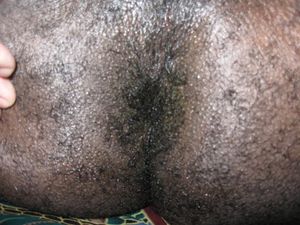 19 yo black hole
