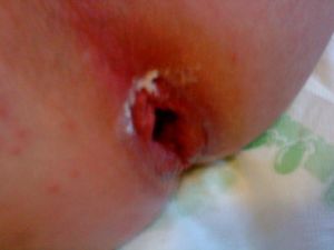 A(FF)ter FFun, waiting FFor hot cum