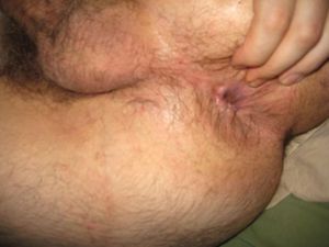 my hole