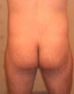 ass