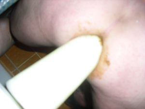 anal01