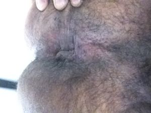 arse