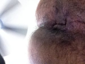 arse1