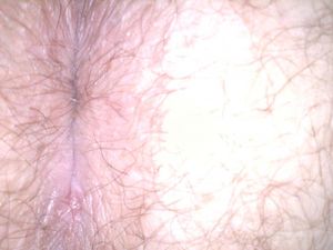 20111103191831