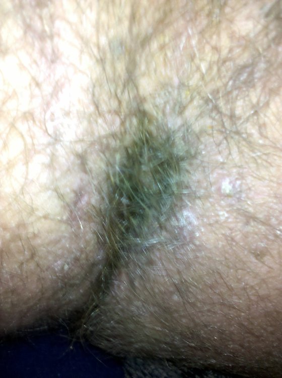 My hairy asshole.jpg