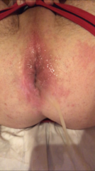 6B7E20EE-7504-4C87-B283-8EC7C31FDDD8.png