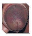 bruised cock.jpg