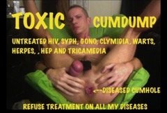 Poz