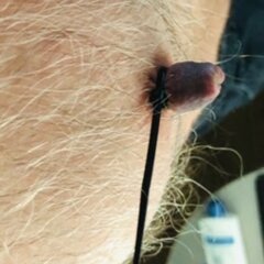 420NippleBare