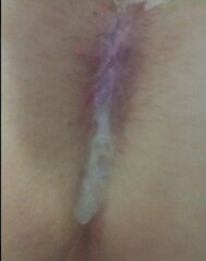my pink hole.jpg
