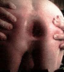 my fisted gaped assholecunt.jpg