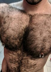 Bilateral Horseshoe Nipple.jpg