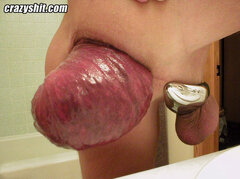 19-giant-anal-prolapse.jpg